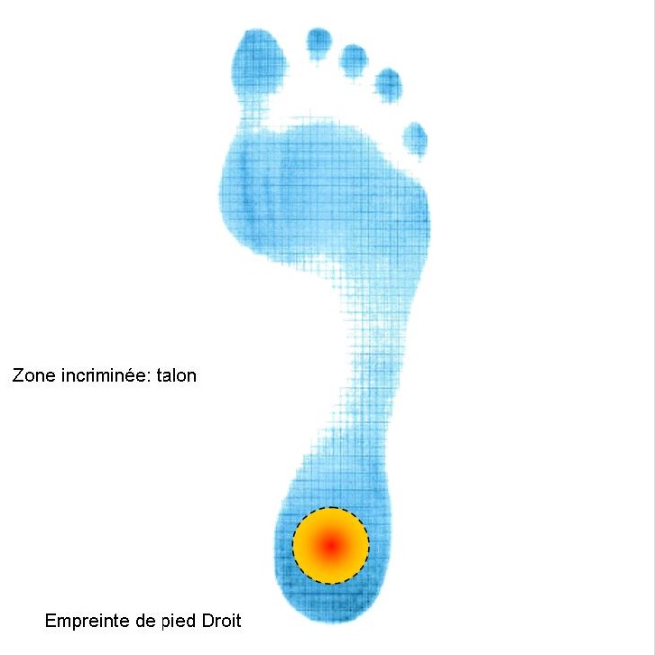 SULPO 3 Paires Demi-Semelles Pour Talons - Soulagement Douleur Métatarse - Silicone Velours - Métatarsalgie